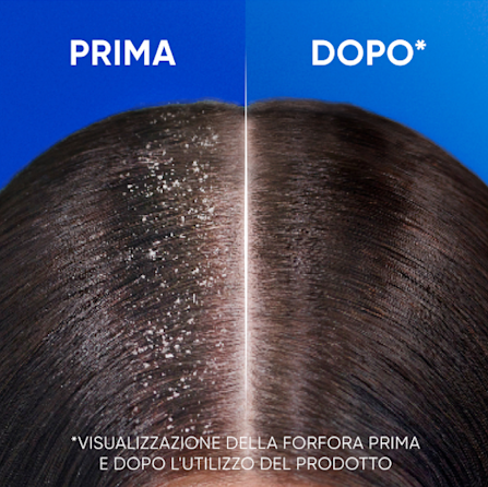 Head & Shoulders Antiprurito 250ML ART.80776328 - immagine 7